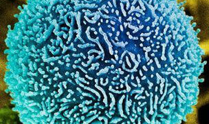 cancer cell