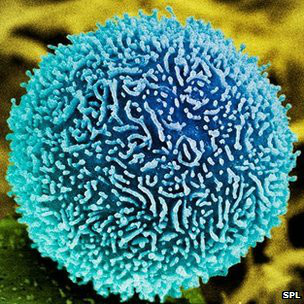 بھارت:کینسر کی سستی دوا بنانے کی اجازت