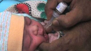 polio
