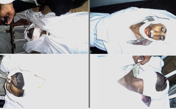 تربت سانحے میں قتل ہونے والے 18افراد کی نعشیں ہسپتال منتقل