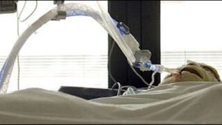 burns patients