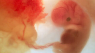 development of fetus at 5 weeks