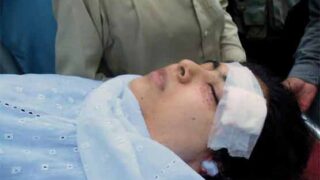 Malala Yousafzai