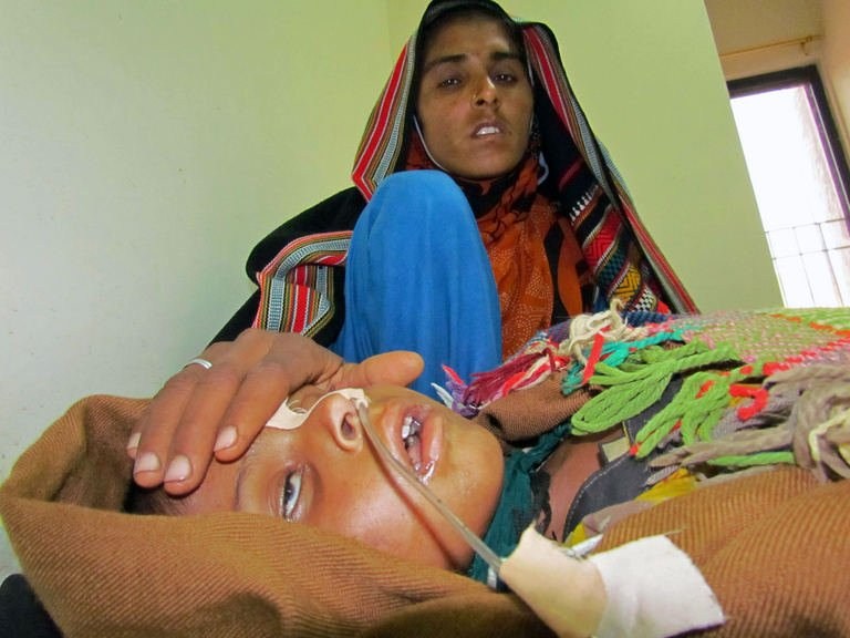 سندھ میں خسرے کی وباء، ہلاکتیں241 ہوگئیں