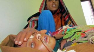 Measles Cases