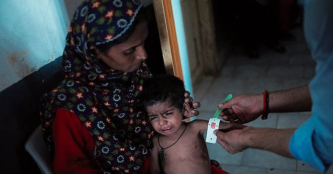 Sindh Measles