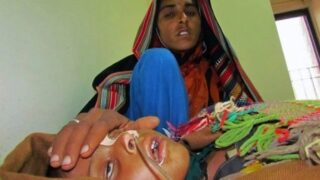Children Died Measles