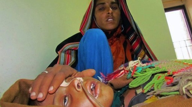 Children Died Measles