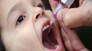 Polio