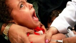 Measles