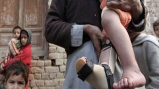 Polio