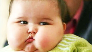 Obesity