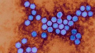 Polio Virus