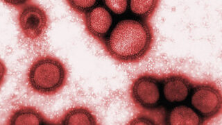Swine Flu