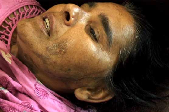 وزیر آباد میں گھریلو ملازمہ پر تیزاب پھینک دیا گیا