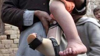 Polio