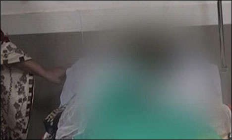 رحیم یار خان: شک کی بناء پر منگیتر پر تیزاب پھینک دیا