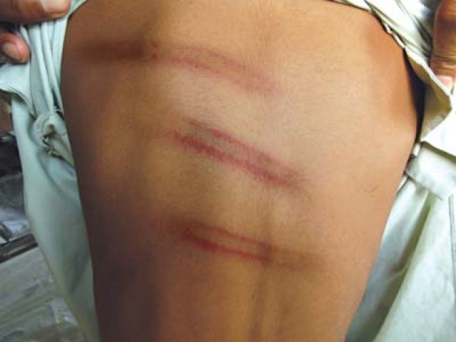 مدرسہ کے قاری نے طالبعلم پر تشدد کی انتہا کر دی