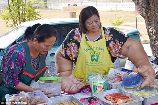 انوکھی بیماری : بڑے بازو , ہاتھ رکھنے والی سیارہ زمین کی واحد تھائی خاتون