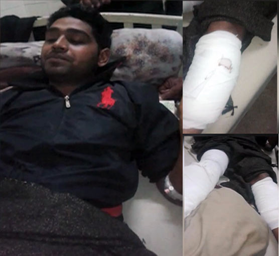 لاہور : وڈیرے کا حجام پر بیہمانہ تشدد، ٹانگوں میں گولیاں مار دیں