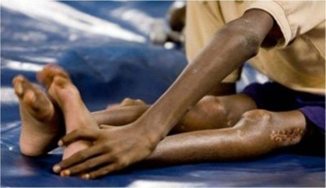 کوئٹہ اور قلعہ عبداللہ  کے سیوریج کے نمونوں میں پولیو وائرس کی تصدیق