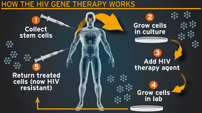 جین تھیراپی کے ذریعے ایڈز کا علاج
