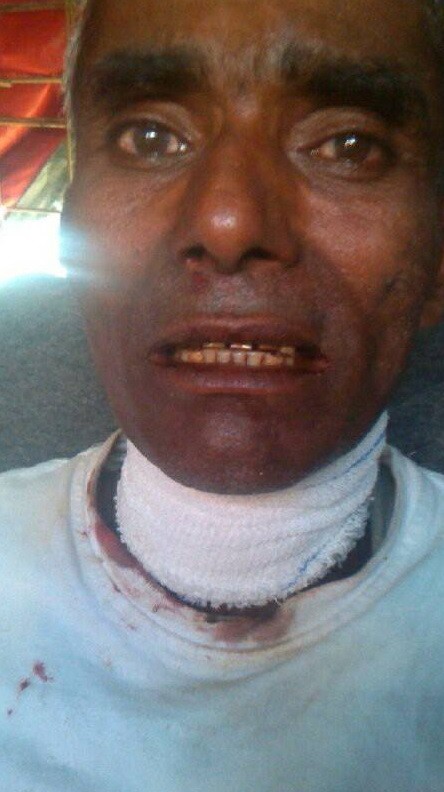 Muslims shot by Burmese police