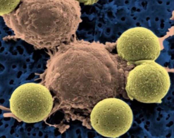 کینسر کے علاج کے لیے خود کش جینز تھراپی تیکنیک متعارف