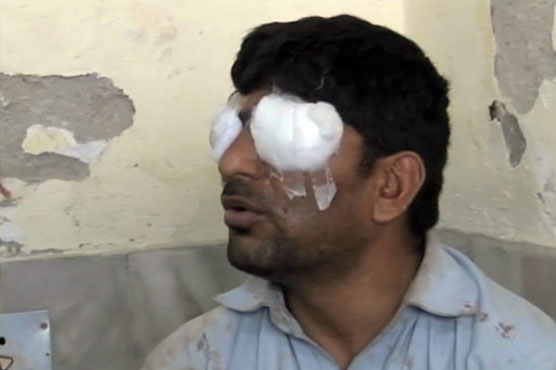 بونیر : قرض کی رقم واپس مانگنے پر چچا زاد بھائی کی آنکھیں نکال لیں