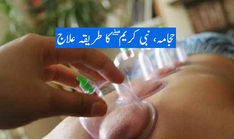 حجامہ، نبی کریم ۖ کا طریقہ علاج
