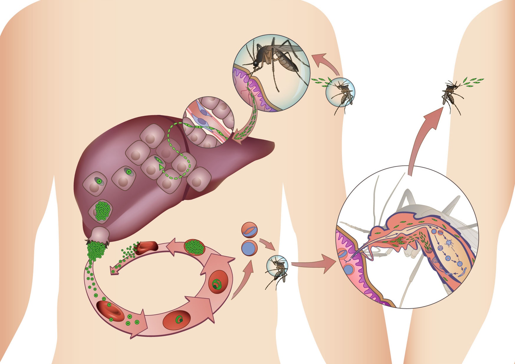 ملیریا کو نظر انداز مت کریں !