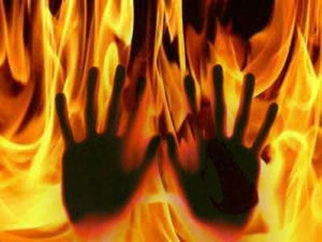 Burned Alive