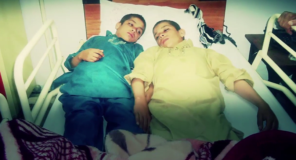 سولر بچوں کا علاج جاری، ڈاکٹرز کی خصوصی ٹیم آج کوئٹہ جائے گی