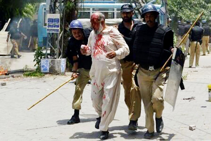 17 جون یوم سیاہ