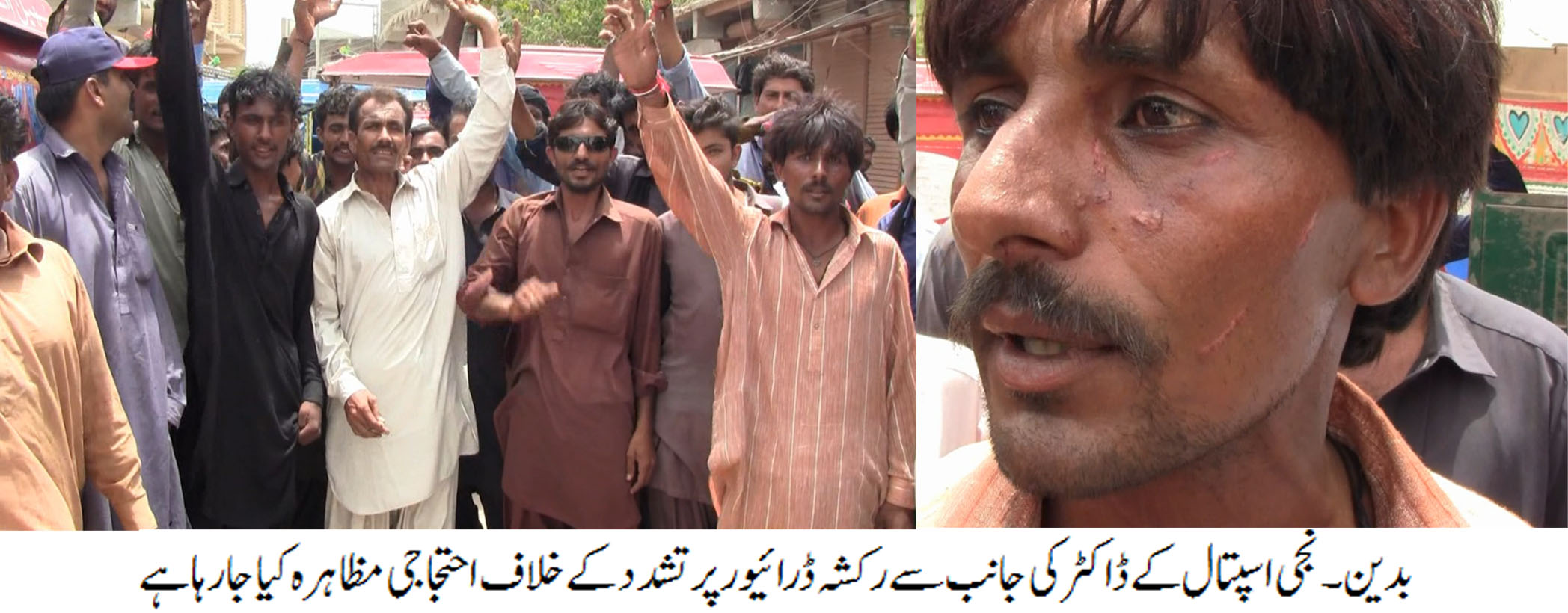 بدین اسپتال کے سامنے رکشا کیوں کھڑی کی، با اثر ڈاکٹر کا غریب رکشہ ڈرائیور پر تشدد