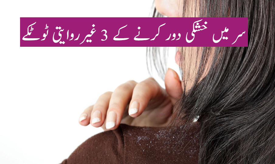 Dandruff