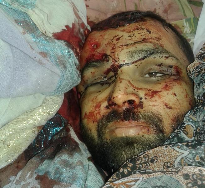 راولاکوٹ کی خبریں 25/8/2016