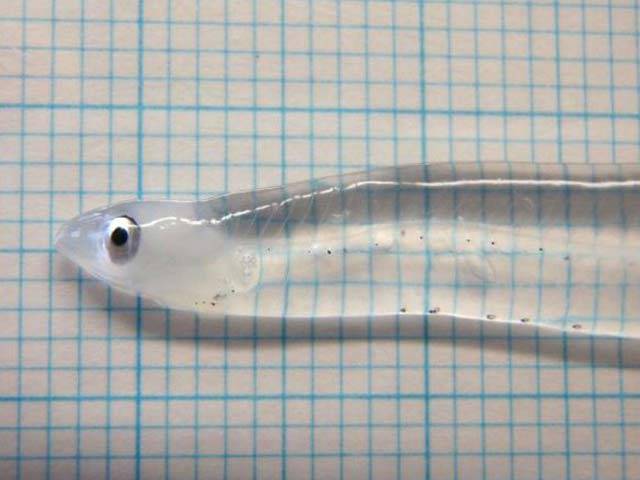 ترک سائنسداں نے گوشت اور ہڈیوں کے آرپار دیکھنے والا نظام بنالیا