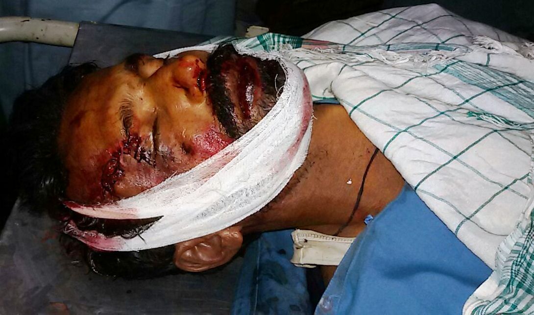 خیرپور ناتھن شاہ میں انڈس ہائے وے پر کار کی موٹر سائیکل کو ٹکر۔ ایک شخص جاں بحق