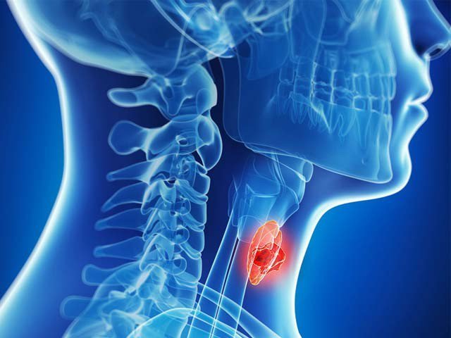 امیونوتھراپی سے گردن اور سر کے کینسر میں غیر معمولی افاقہ