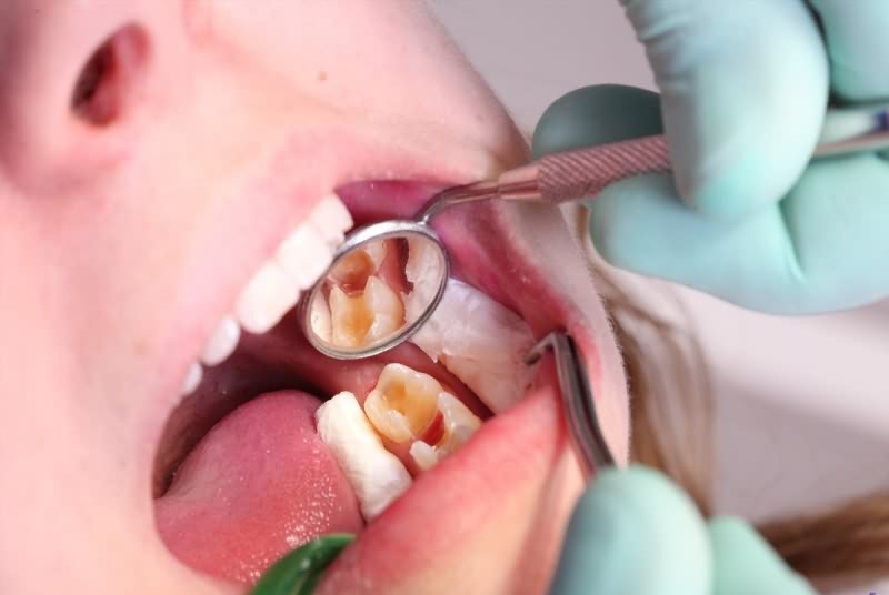 امراض دندان و منہ، تحفظ اور علاج