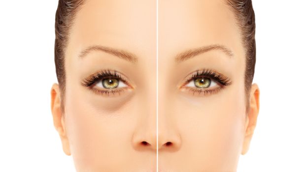 Eyes Dark Circles Women