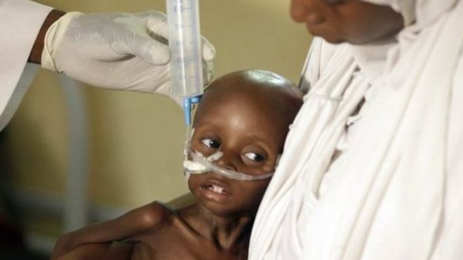 نائجیریا میں 75 ہزار بچوں کے بھوک سے مرنے کا خطرہ