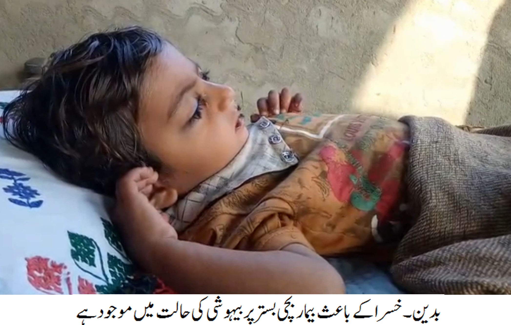 بدین کے نواحی علاقوں میں خسرہ سے بچاؤ کے ٹیکے نا لگنے کے باعث دو بچے جاں کی بازی ہار گئے