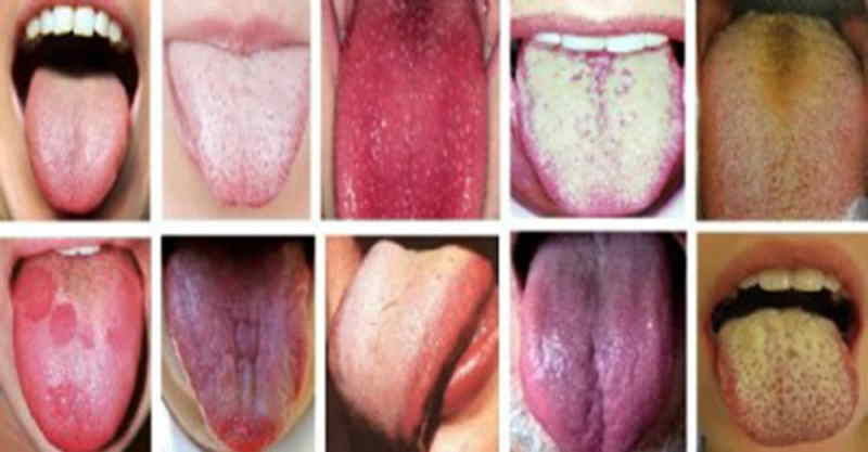 زبان اور ہماری صحت