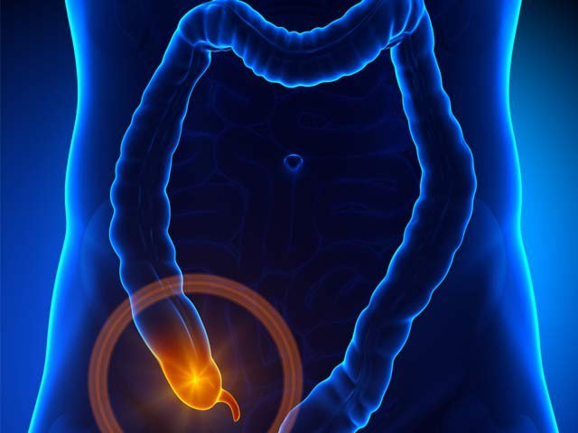 ایک عرصے تک بے کار سمجھا جانے والا ’اپینڈکس‘ بہت کارآمد نکلا
