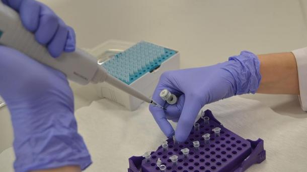 ہالینڈ نے نوجوانی کی اکسیر تیار کر لی