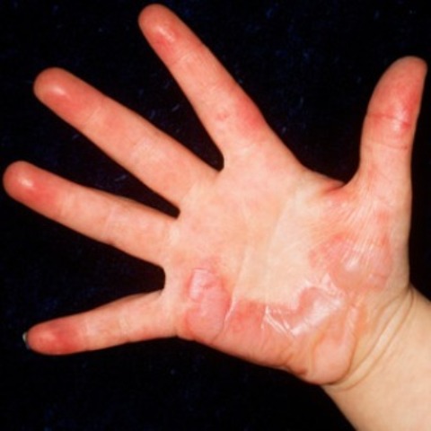 آگ پروف بچے