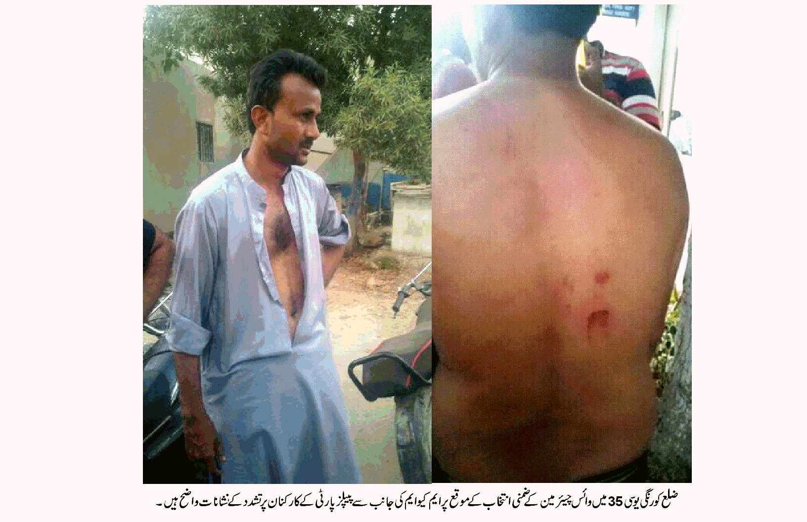 یونین کمیٹی 35 ضلع کورنگی میں ضمنی انتخاب کے دوران کارکنان پر تشدد کی مذمت