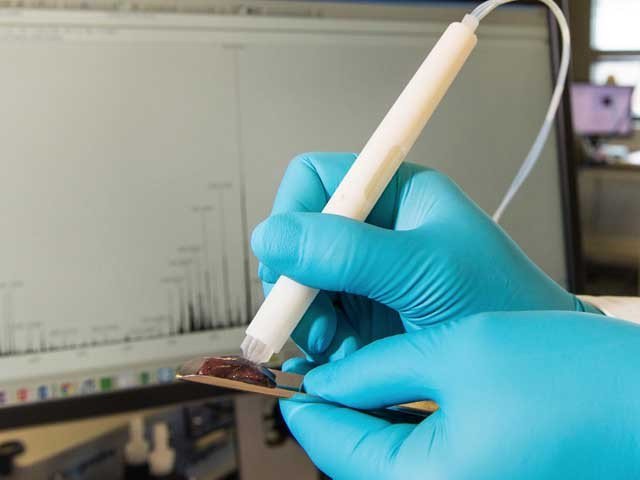 صرف 10 سیکنڈ میں کینسر کی شناخت کرنے والا قلم